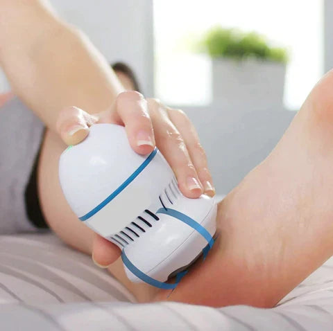 Lumora Vacuum Callus Remover